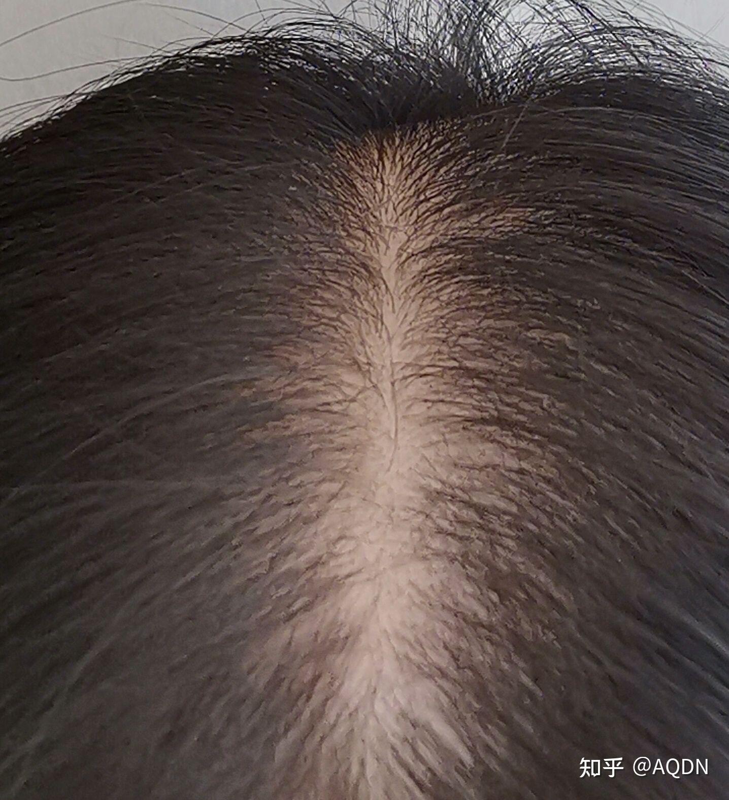 我的头发好像变多了😁😁😁 - 知乎