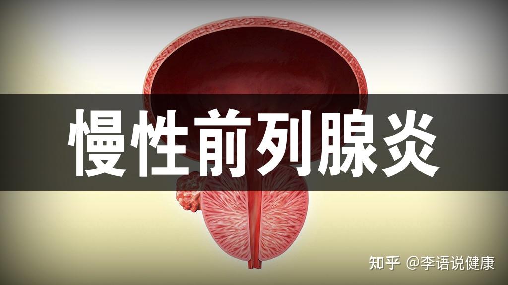 前列腺炎和前列腺增生有什么区别? - 知乎