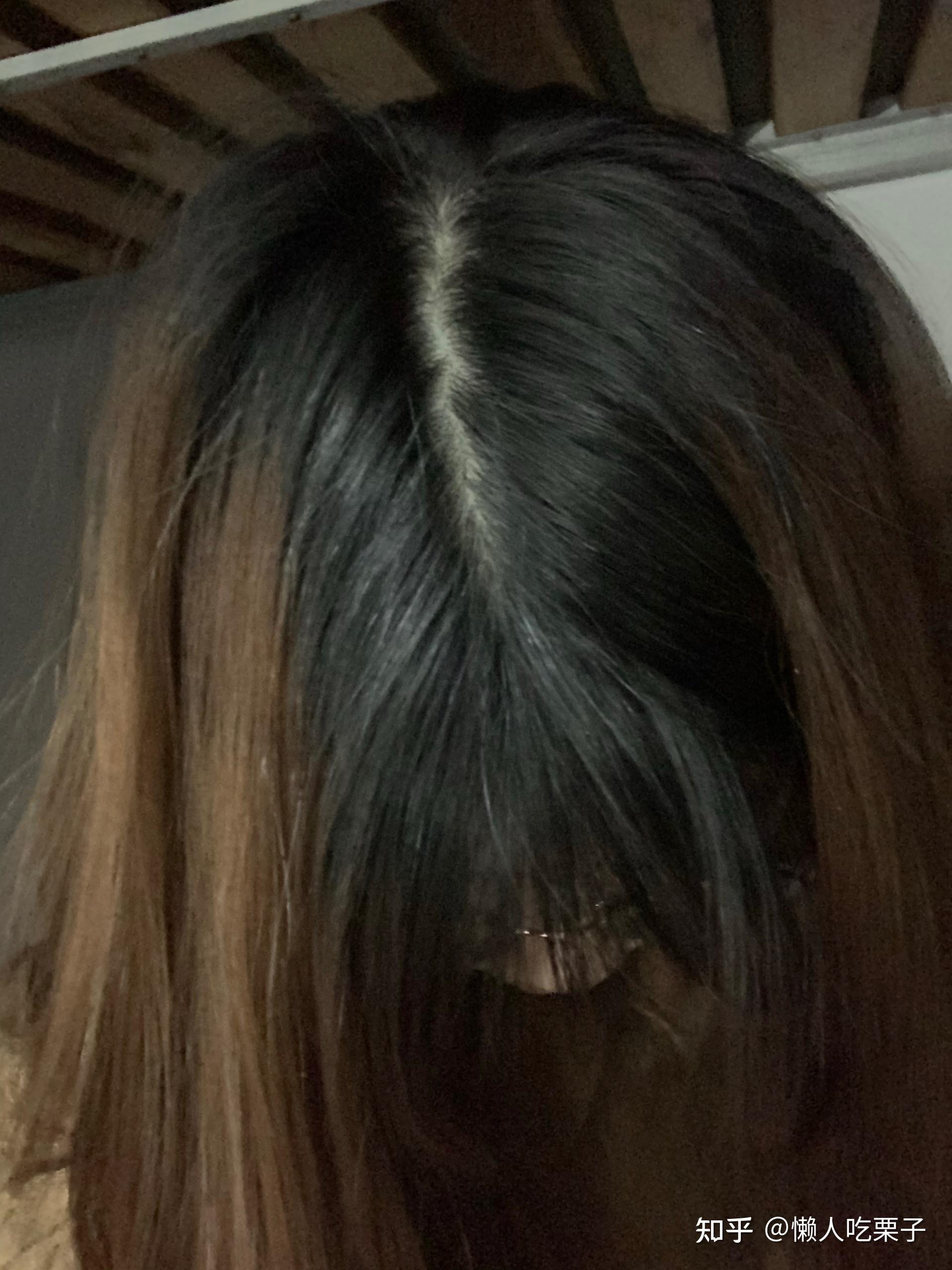 这样的发缝宽度算正常吗? - 知乎