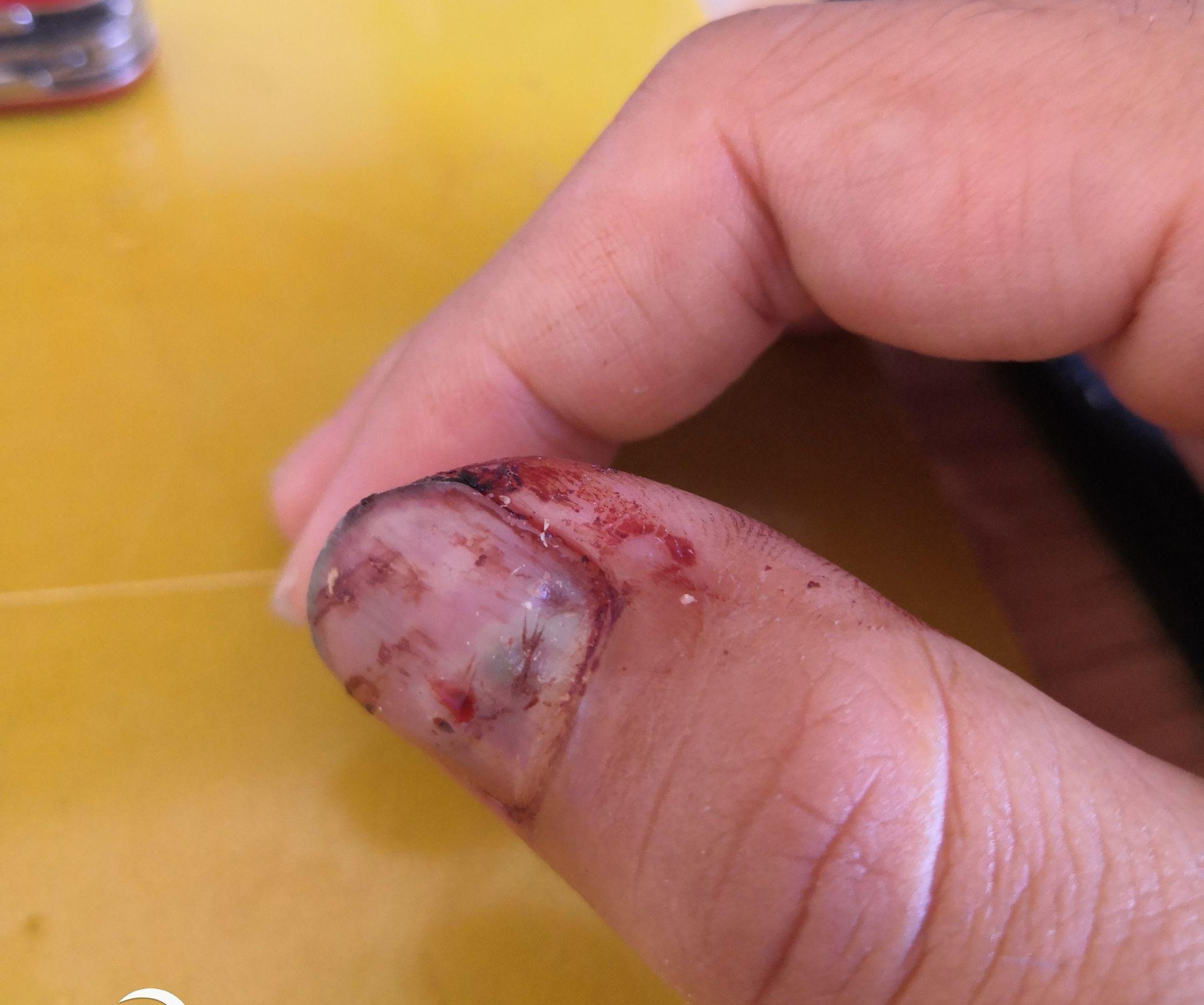 手被车门夹了怎么办? - 知乎