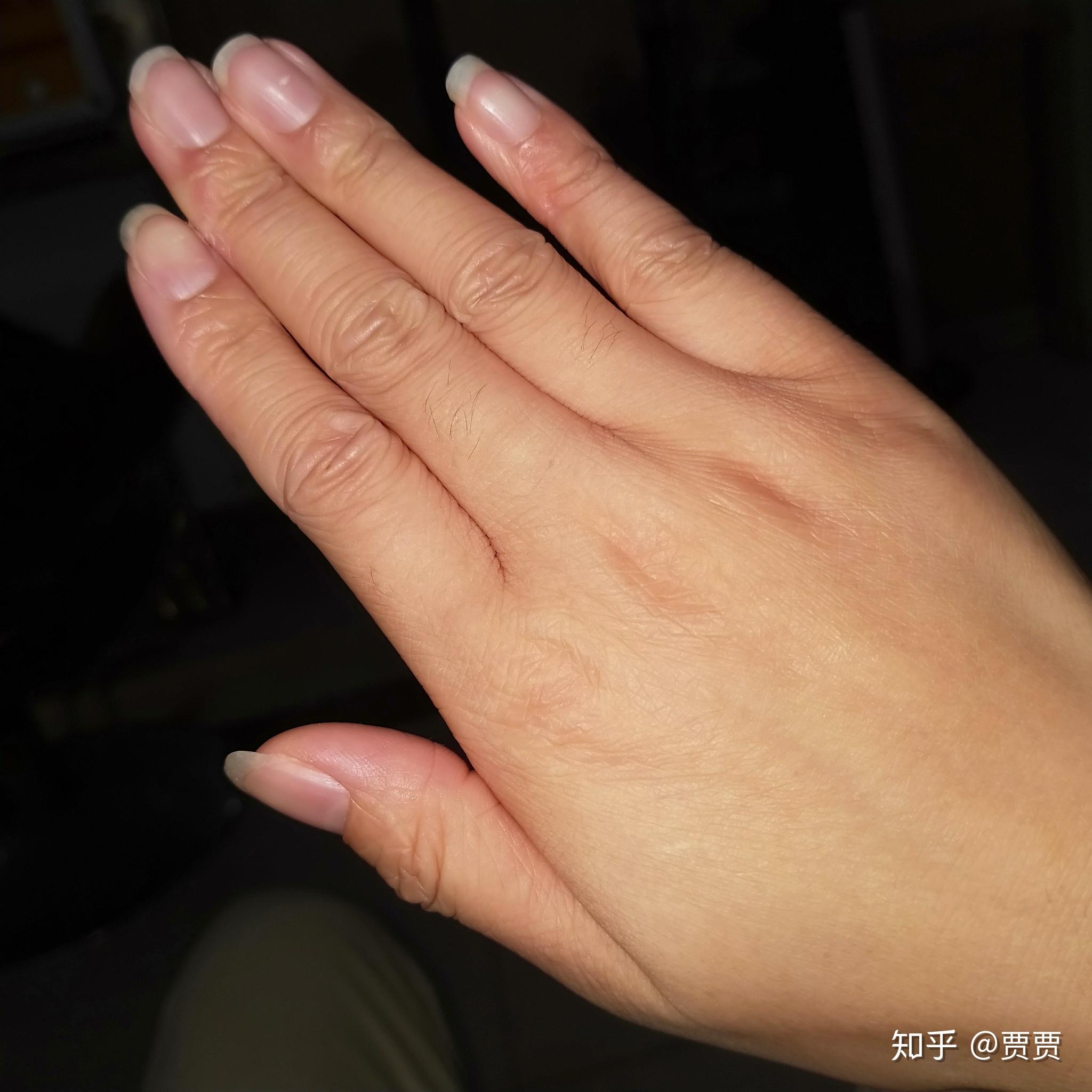 21岁女生手上很多皱纹,像老人的手一样? - 知乎