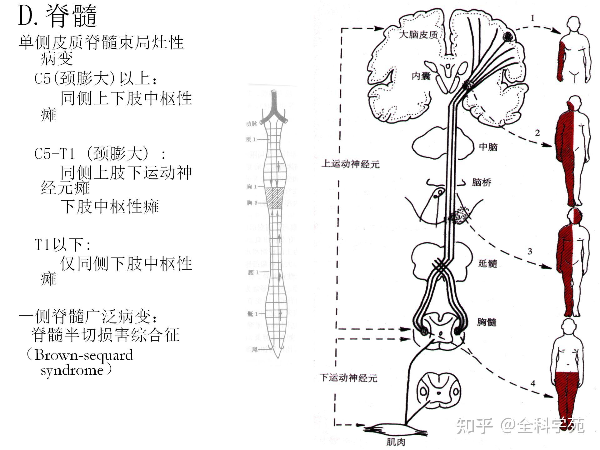 皮质核束传导通路图片