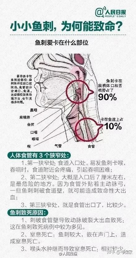 卡在喉咙里的小鱼刺后来何去何从了