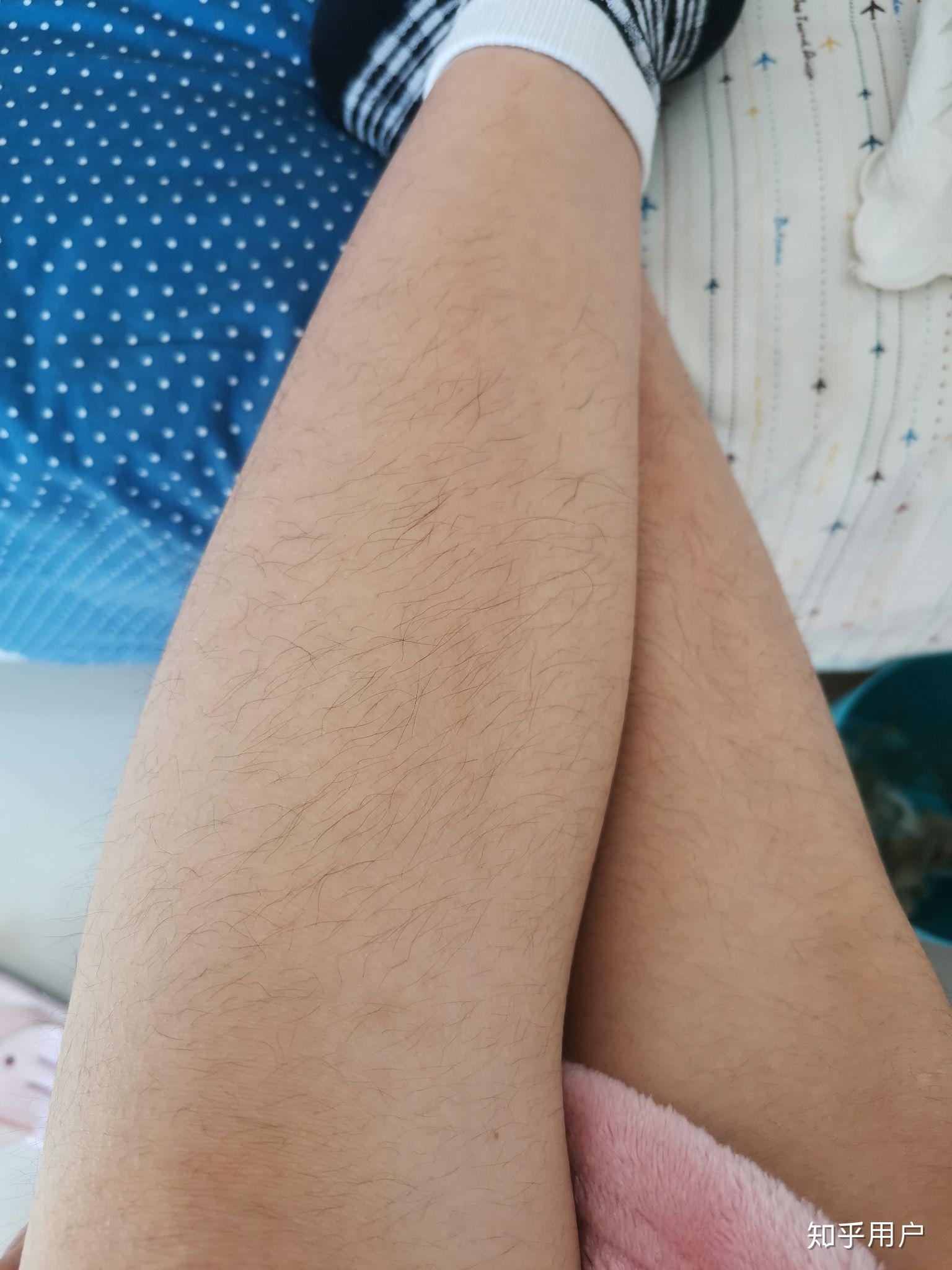 女生有腿毛会很自卑吗