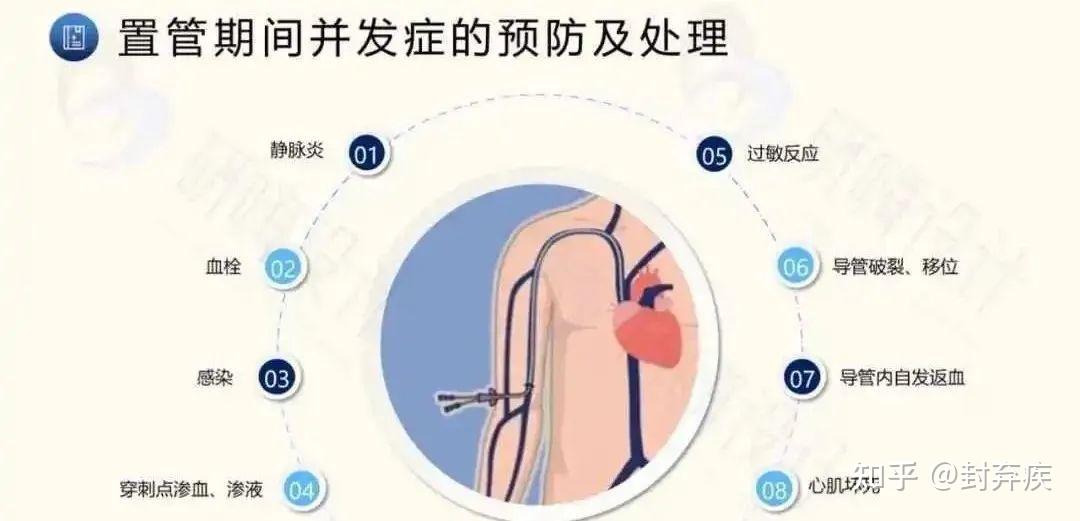 守护“生命通道”:PICC导管全面维护指南与日常须知 - 知乎