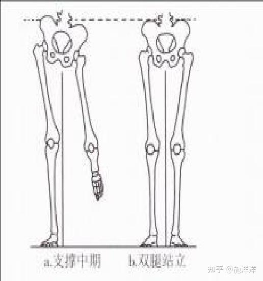 正常人步态分析指标有哪些？ - 知乎