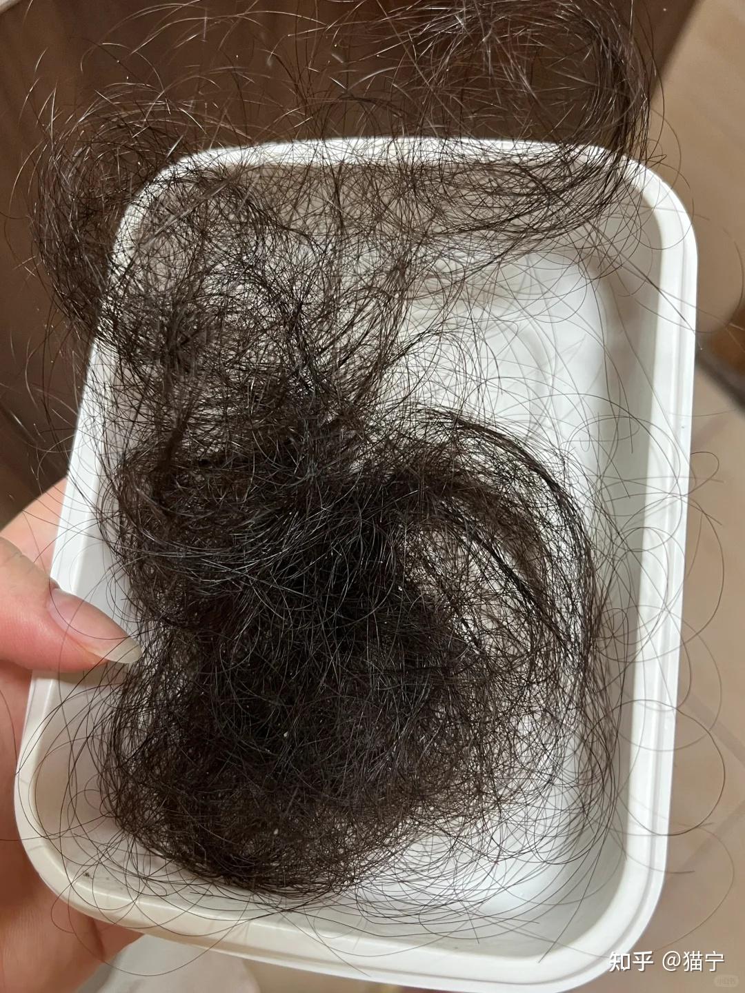 为什么会掉头发女生为什么在线