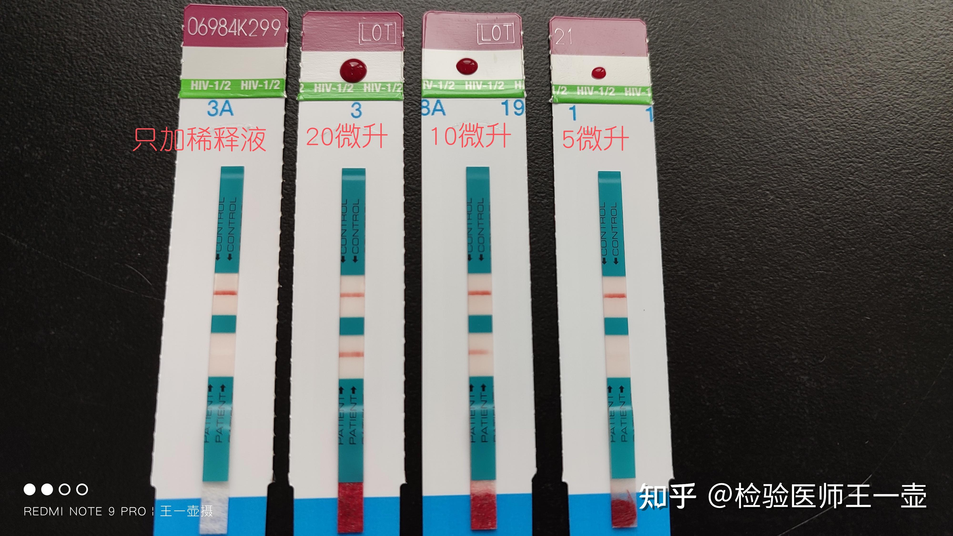 hiv试纸血量少会影响结果吗比如我这种情况如图
