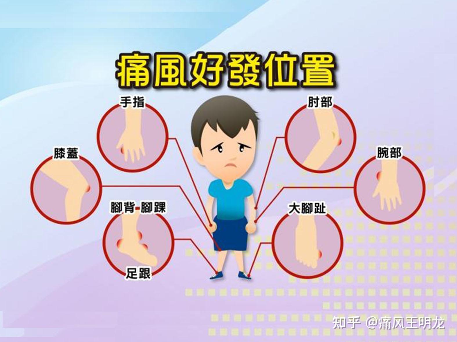 痛风部位图片 位置图图片