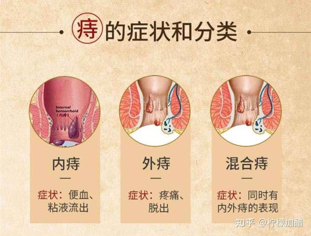 酮康唑栓要塞多深图片