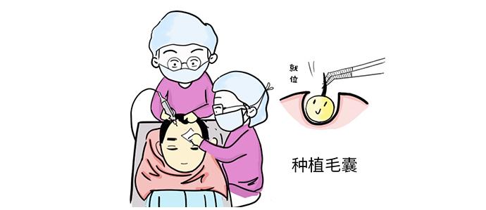 种植头发贵吗头发种植多少钱一根