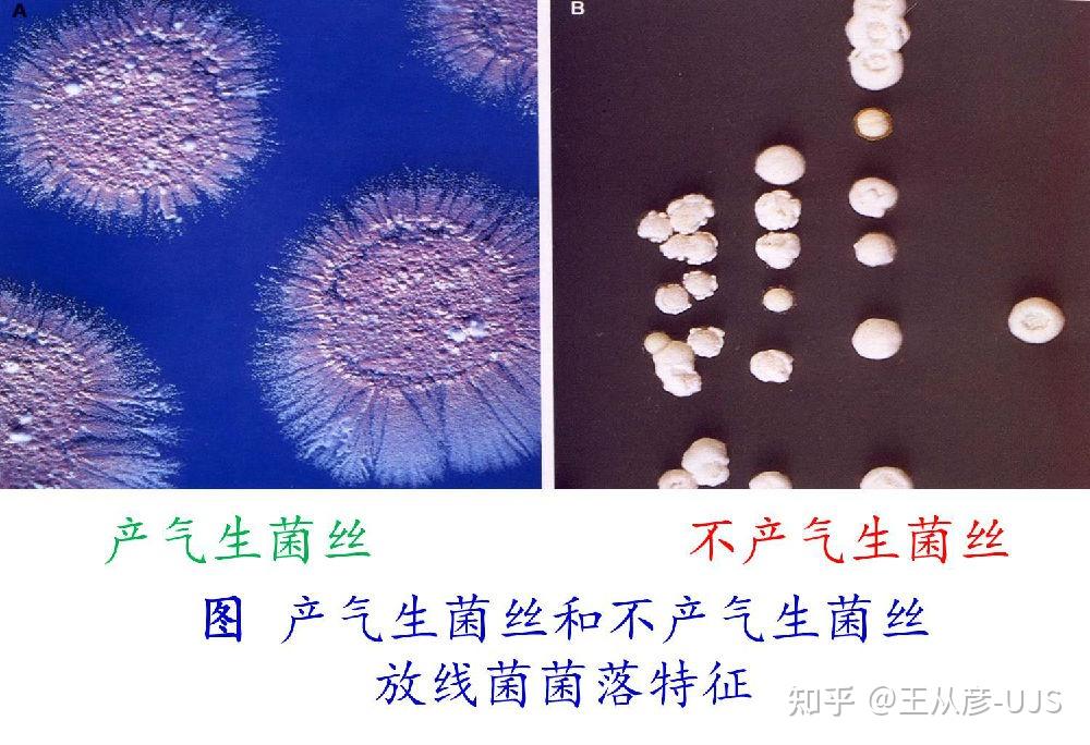 环境微生物之放线菌 - 知乎