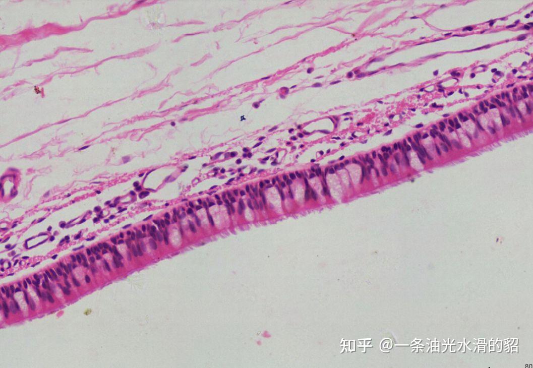 上皮細胞分單層和復層請問怎樣理解假復層纖毛柱狀上皮只有一層