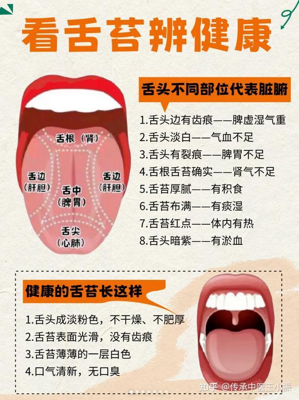 舌诊其实很简单，一文教你怎么看舌头，轻松掌握身体健康 - 知乎