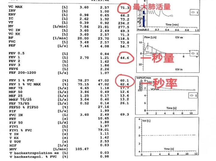 肺功能检查结果知多少？哪些指标最重要？ - 知乎