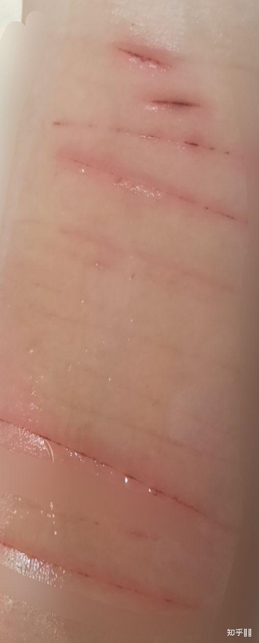 如果感到生命豪无意义也找不到有意义的事情并且对所