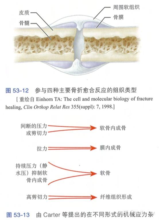 骨折愈合（骨再生） - 知乎