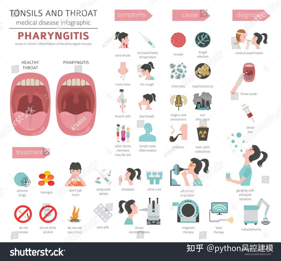 一图读懂慢性咽喉炎Chronic pharyngitis - 知乎