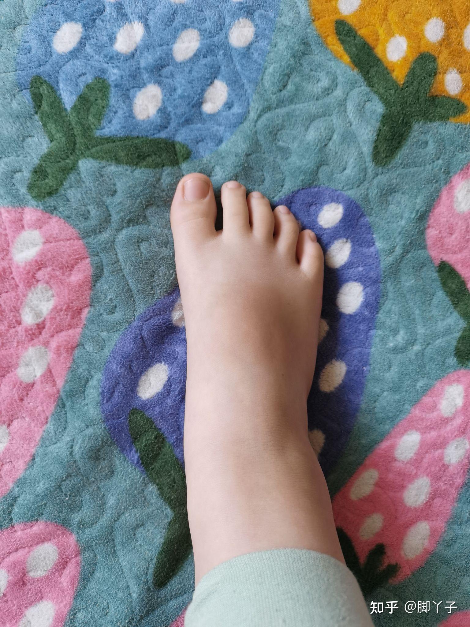 男孩脚底照片有什么问题吗? - 知乎