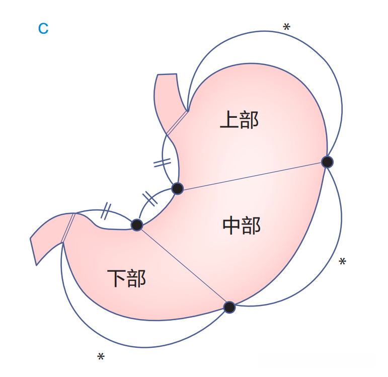 胃镜・解剖学基础：胃篇 - 知乎