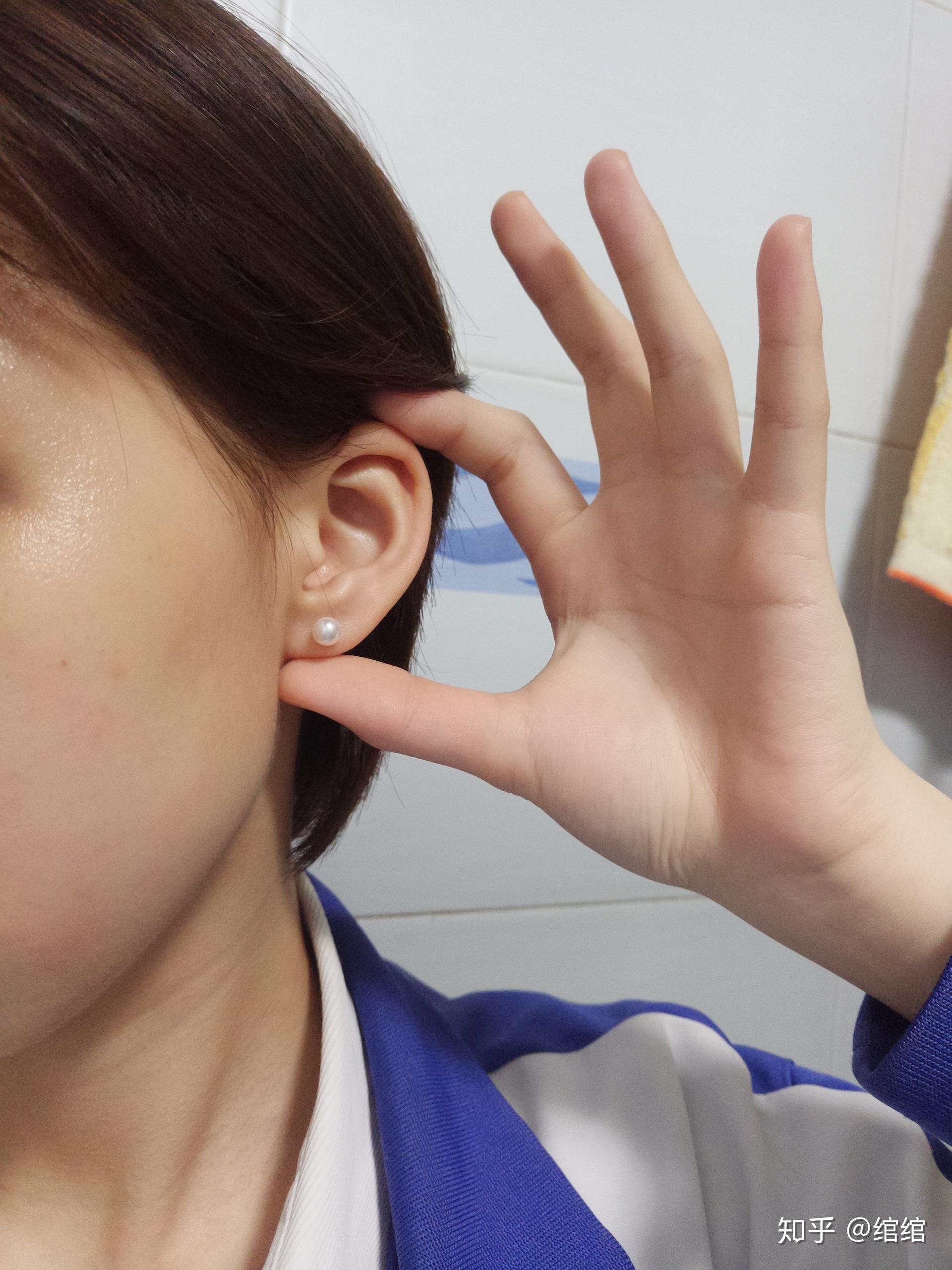 耳洞发炎红肿化脓艰辛恢复历程 - 知乎