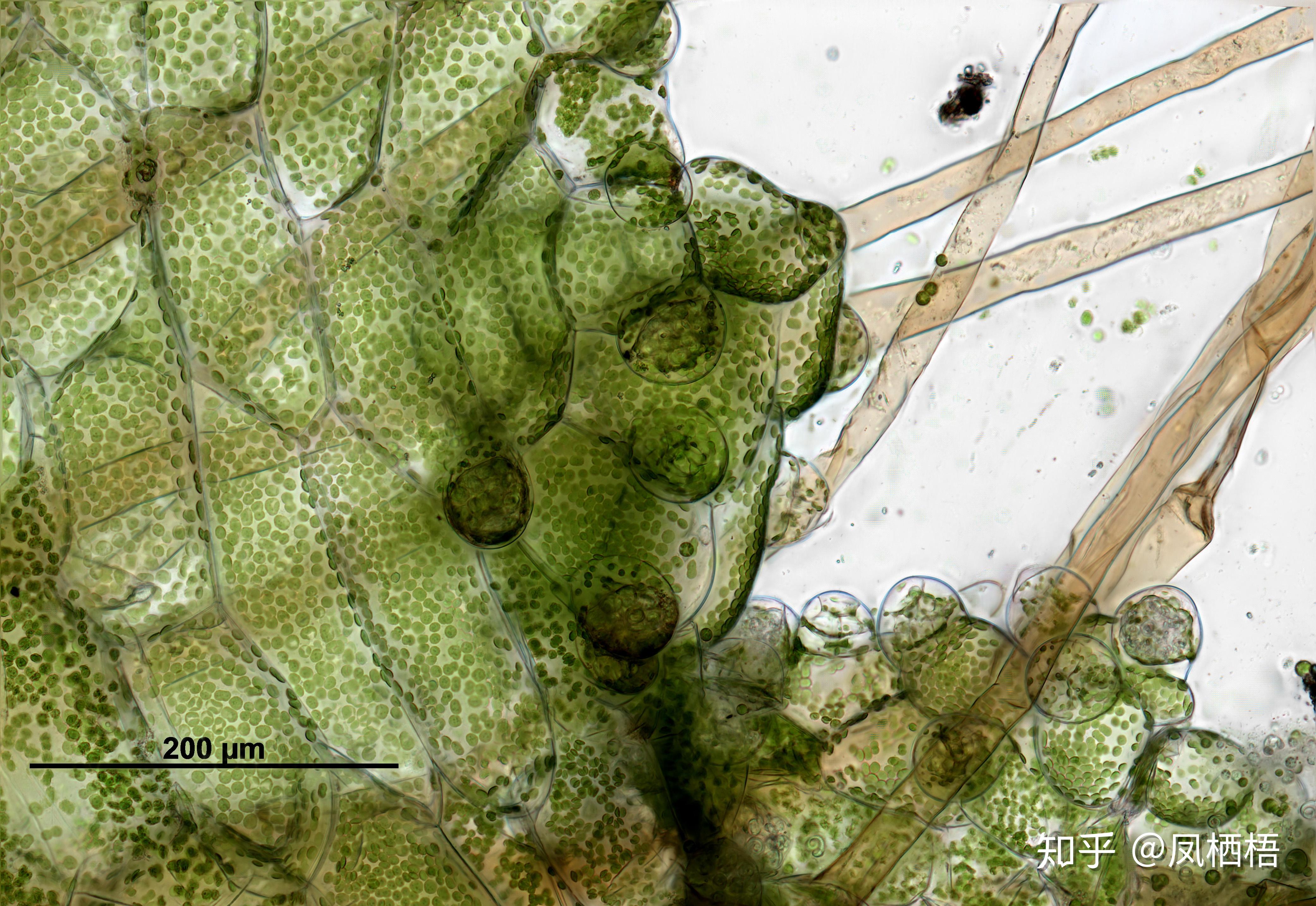 这是蕨类的孢子,为什么在十倍镜下像是一串葡萄,是多个孢子的聚合体?