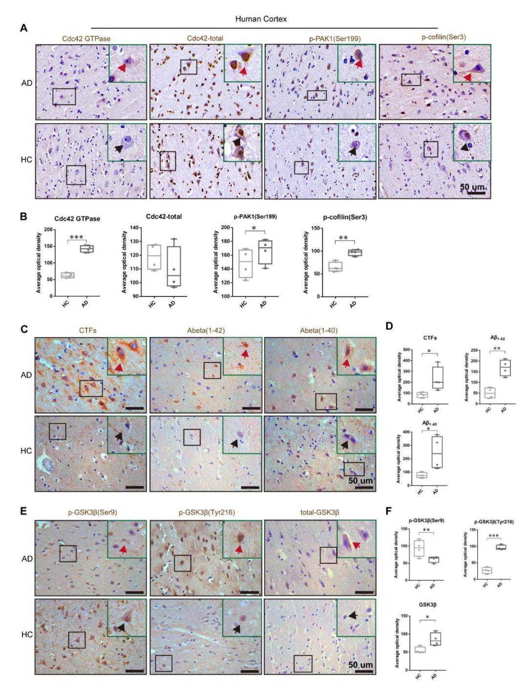 Brain：阿尔茨海默病认知功能障碍的潜在新靶点——Cdc42 - 知乎
