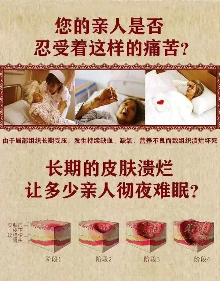 褥疮压疮的致命真相:每年6万生命消逝的警示 - 知乎