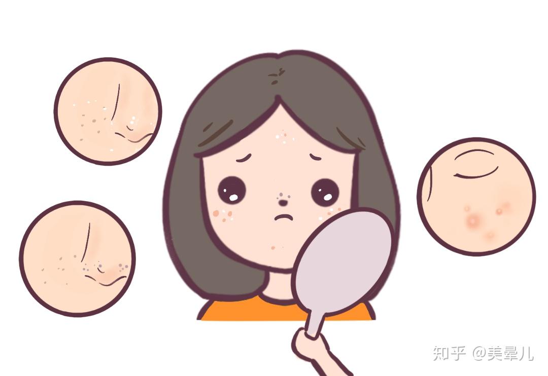 这是角质型毛孔粗大吗