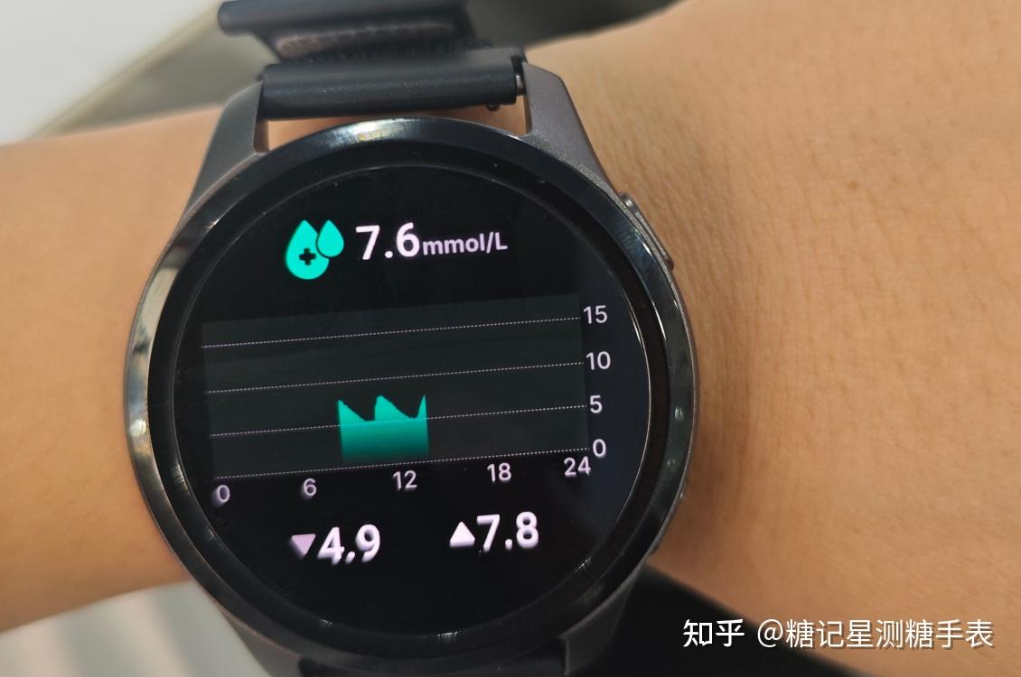 从质疑到长期佩戴|数码博主视角拆解糖记星测糖手表,无创监测穿戴该怎么理性选