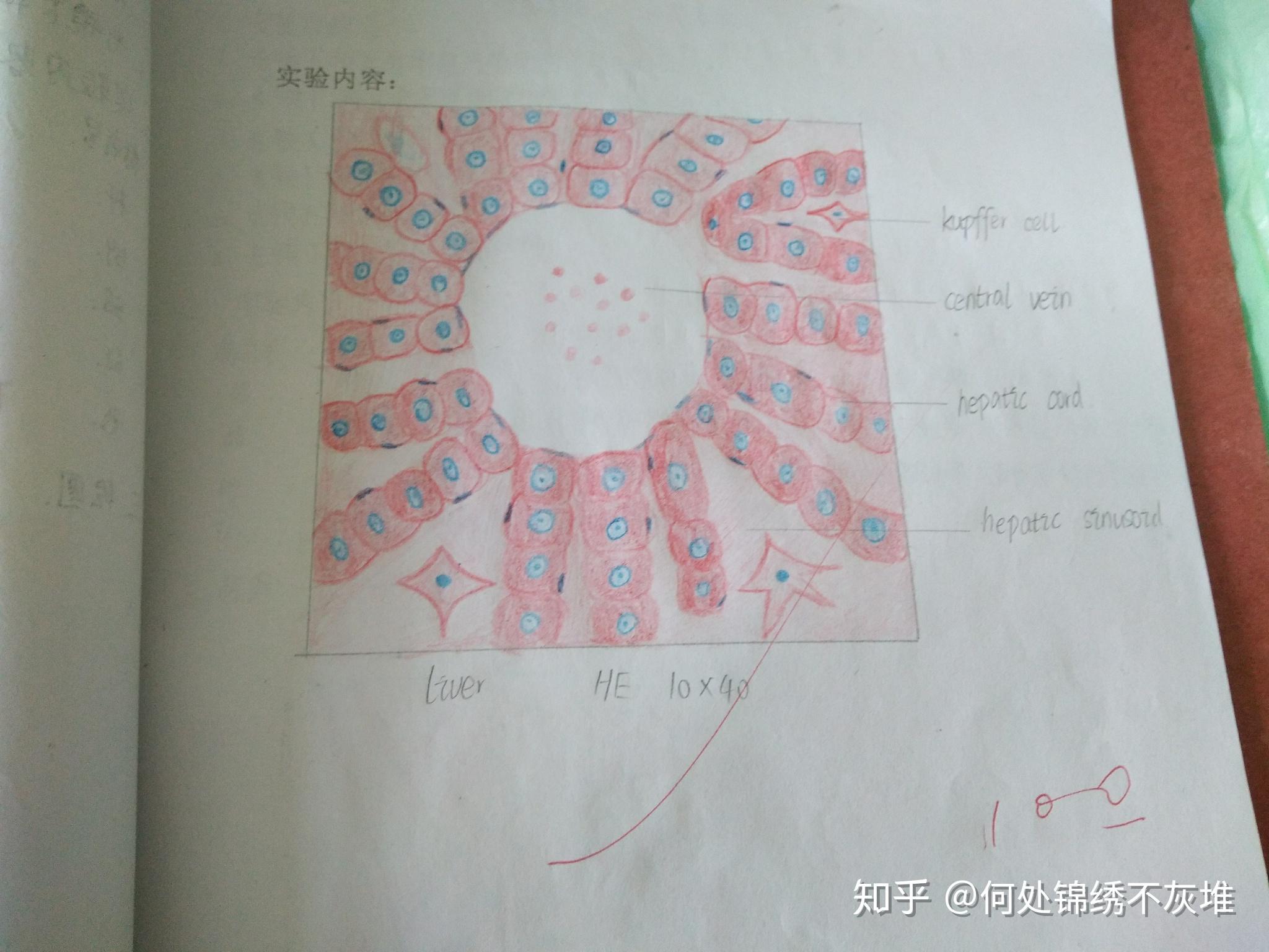 高倍鏡下肝小葉和門管區紅藍鉛筆手繪圖