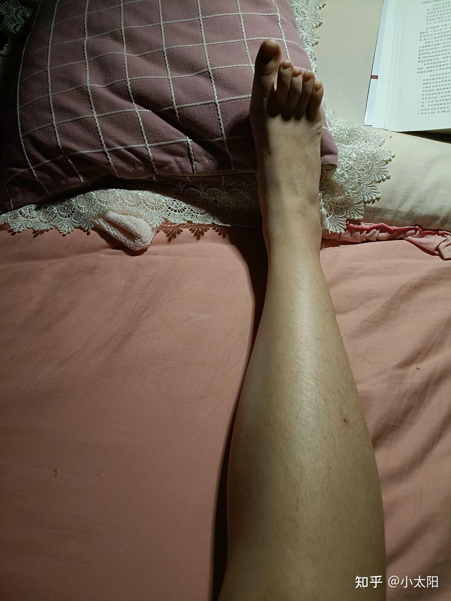 大脚趾特别长比其他脚趾长很多的人在现实中存在吗