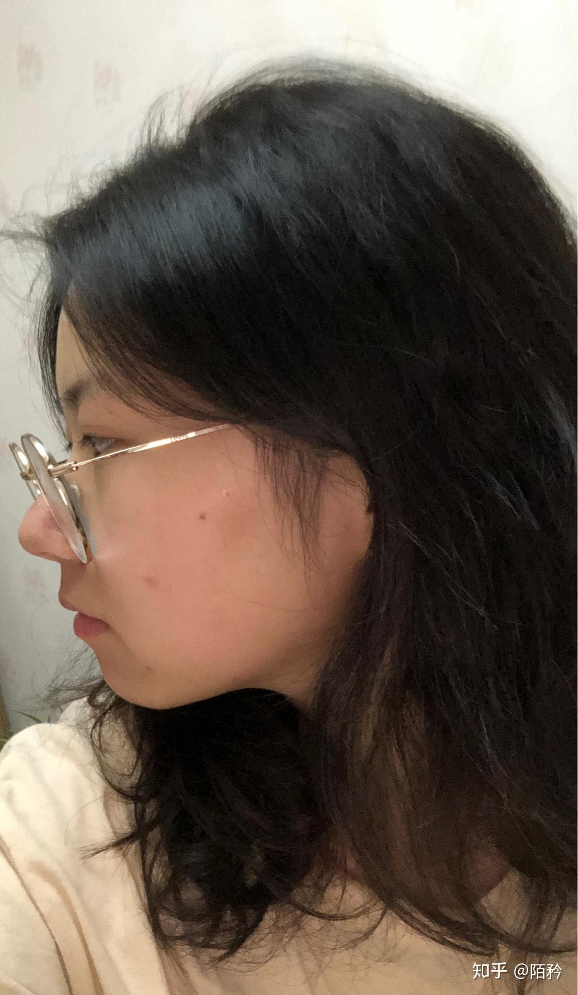 没有山根是种什么体验