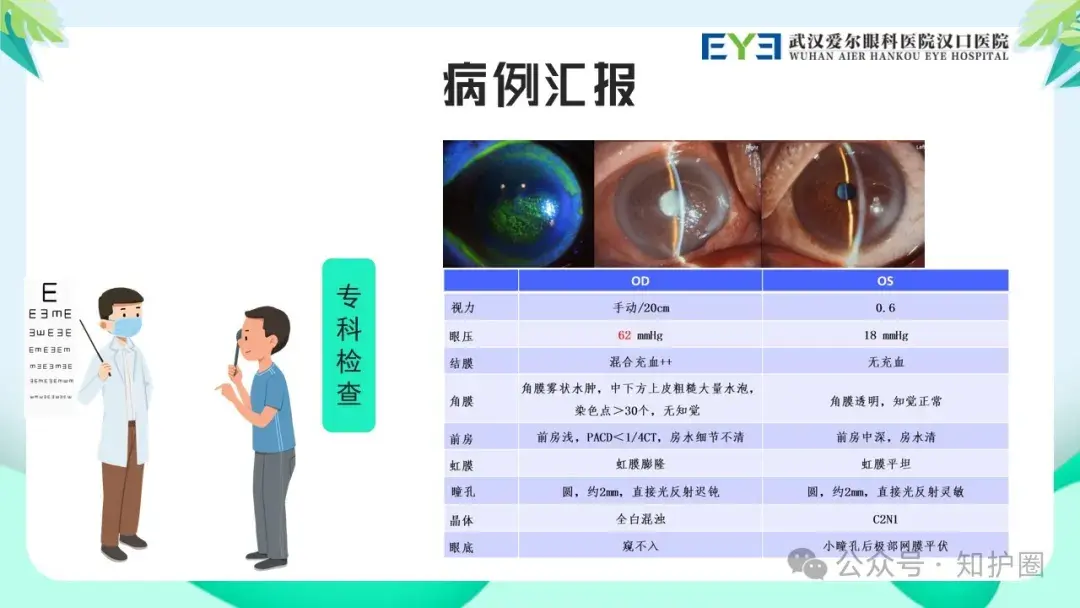 PPT】眼科疑难病例讨论：晶状体源性急性闭角型青光眼护理查房- 知乎