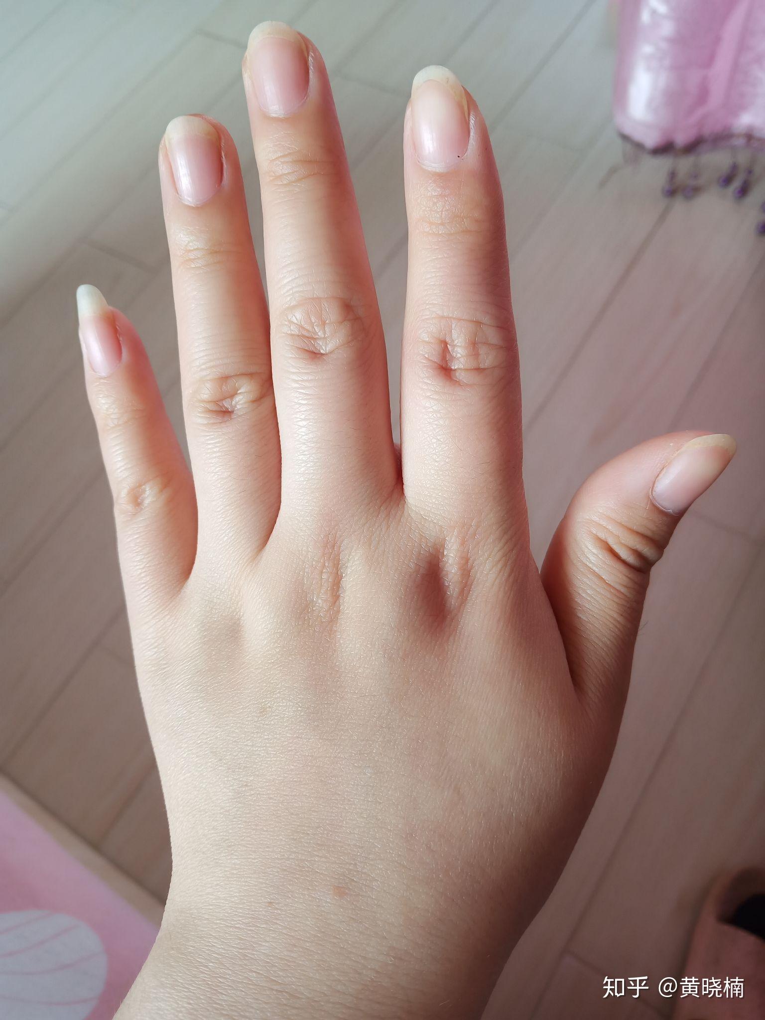 瘦瘦的女生有一双肉肉的手是什么体验? - 知乎