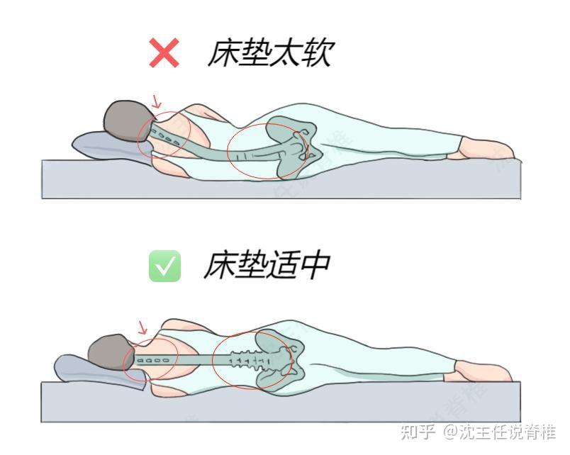 睡硬板床可以缓解腰痛，是真是假？看完这一篇文章，你就明白了 - 知乎
