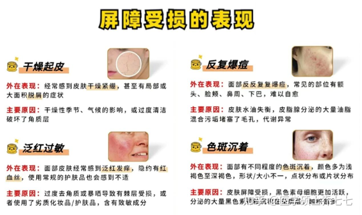 新手刷酸必看:超全刷酸教程!这两个刷酸步骤大多数新手都会忽略!!医学硕士教你如何正确刷酸!!