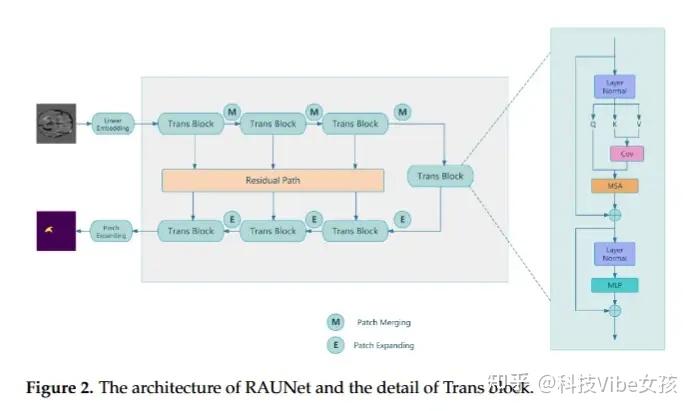 Raunet 直接起飞!Transformer+U-Net,2025依旧炙手可热! - 知乎
