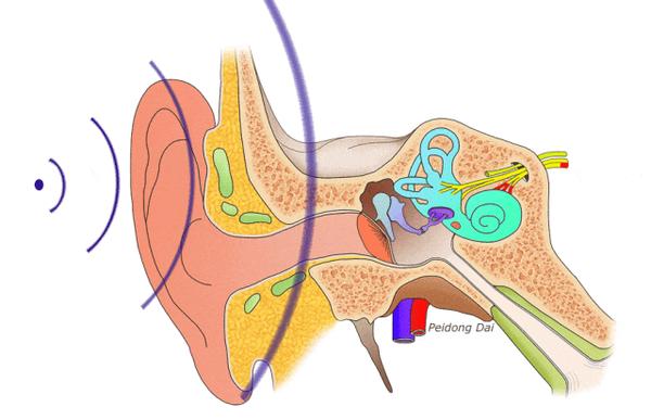 鼓室声导抗图怎么看? - 知乎