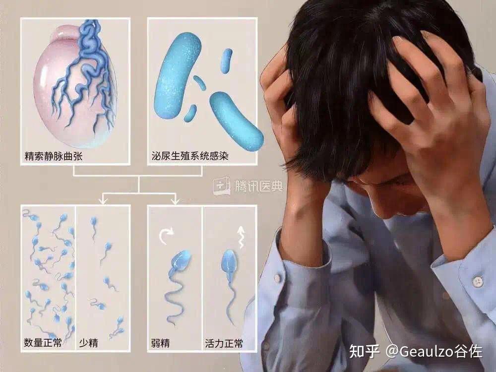 精子质量不好的男性都是怎么备孕的我老公的精子质量不好应该怎么调理