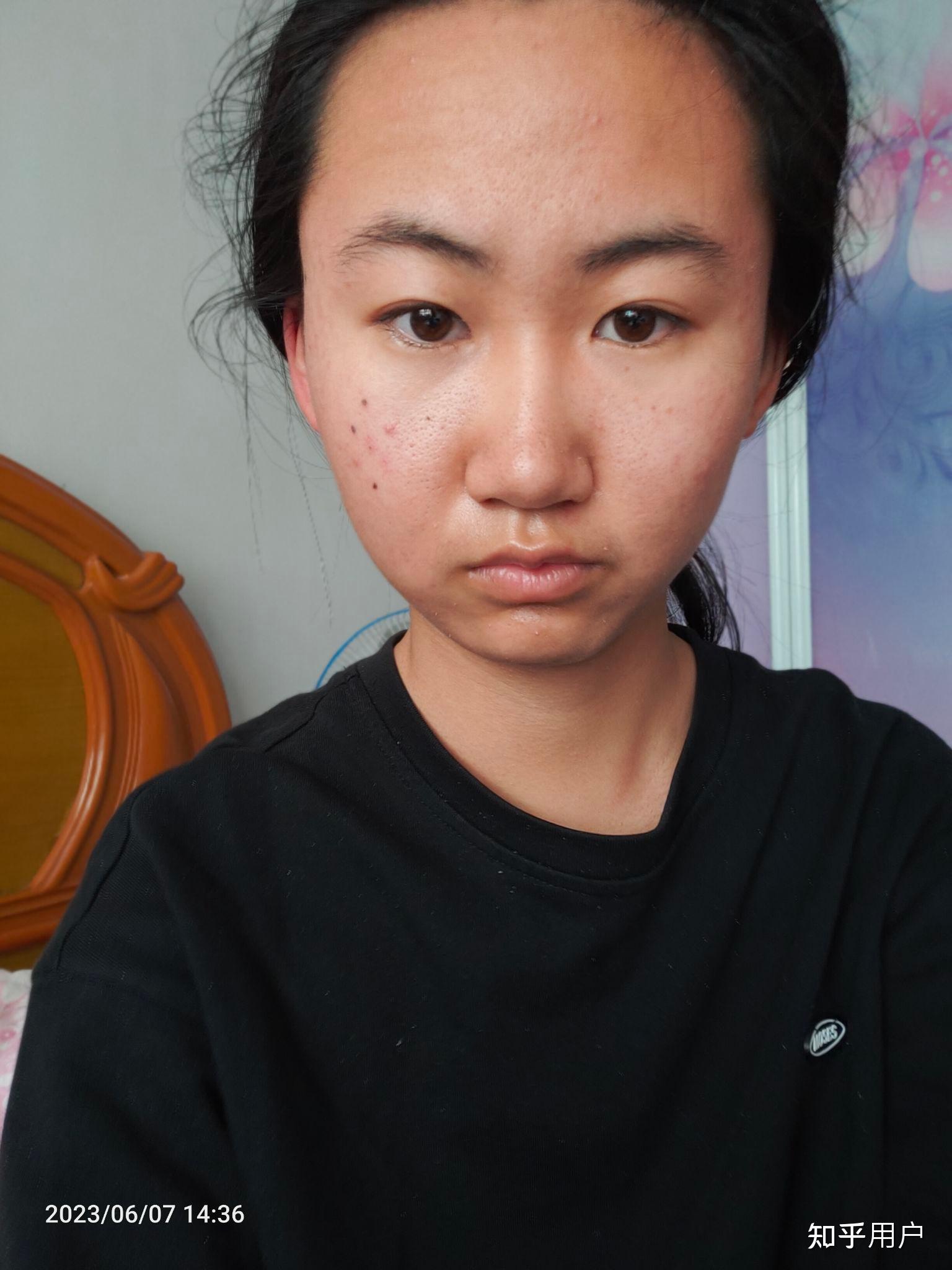 女生长得特别丑怎么办