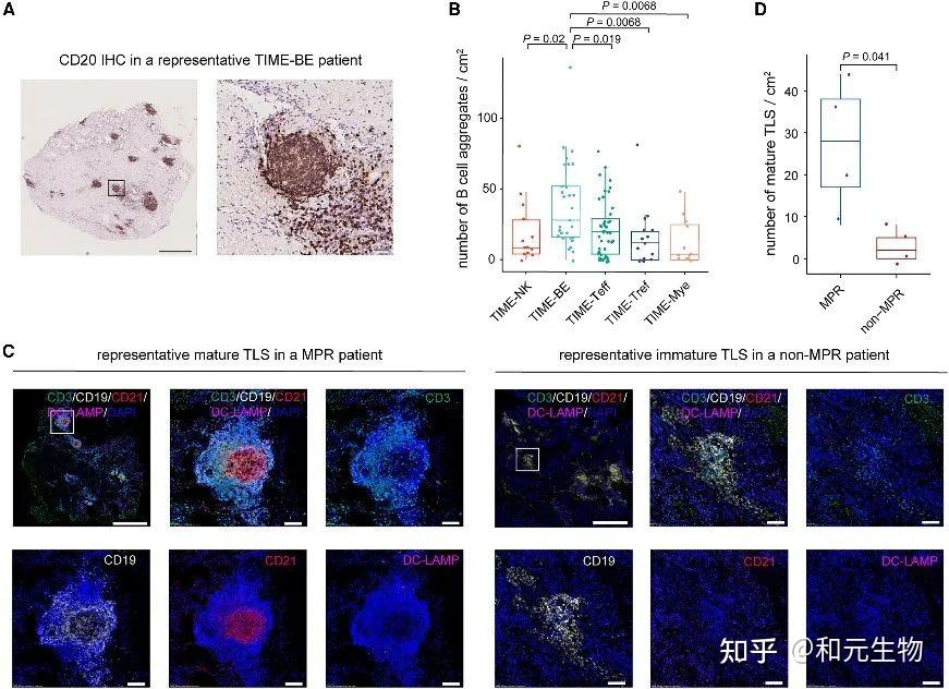Cell｜高树庚教授与张泽民院士团队共同揭示非小细胞肺癌PD-1治疗后的免疫微环境异质性 - 知乎