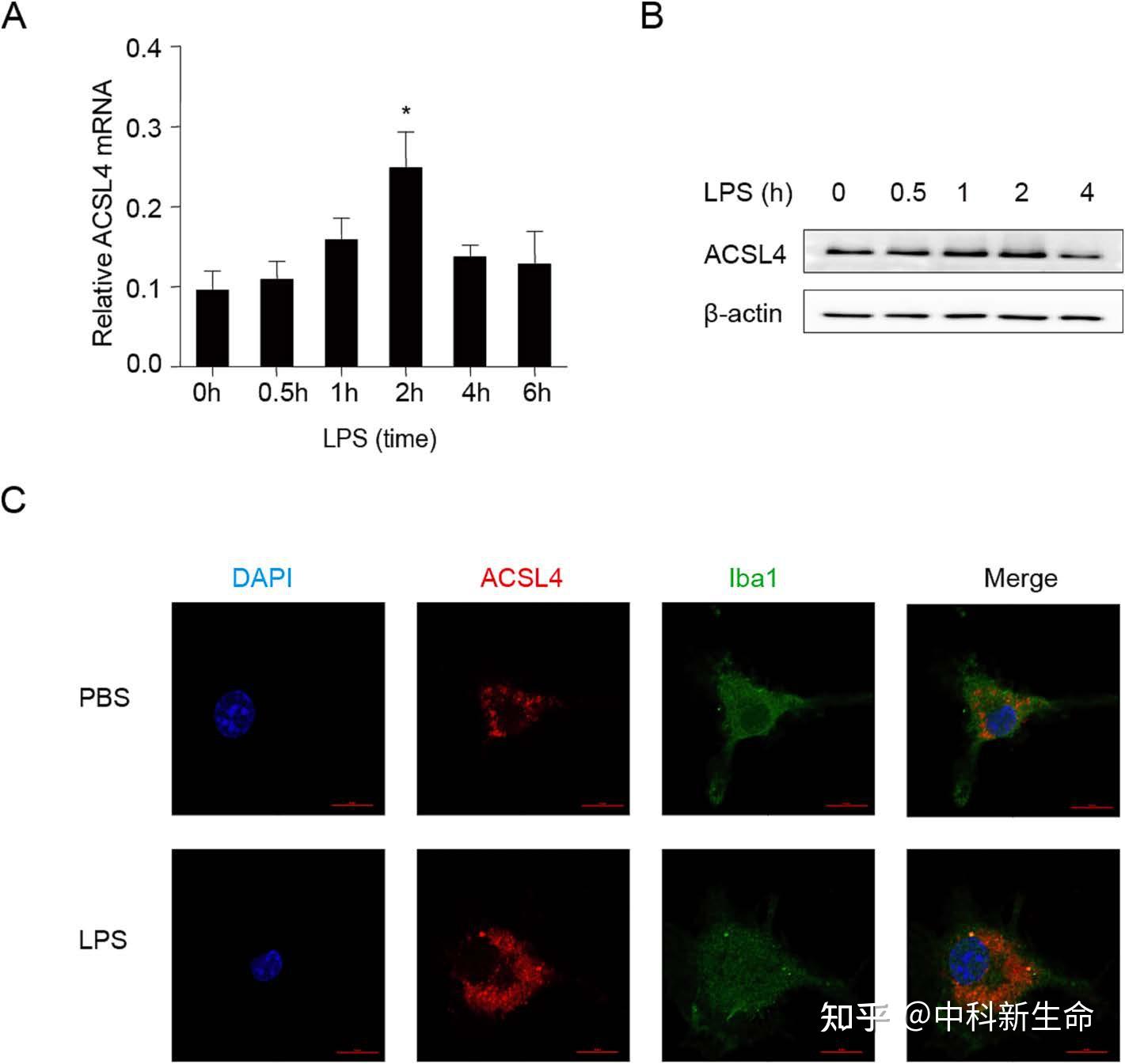 项目文章Brain Behav Immun (IF 19.227) |青岛大学崔玉课题组发现ACSL4促进神经炎症新机制 - 知乎