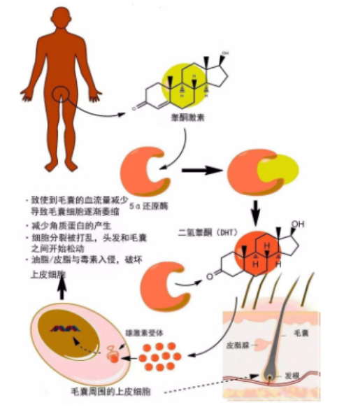 都说脱发是因为雄性激素过多导致的雄性秃那如果补充雌性激素是否可以