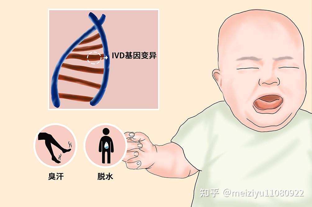 孩子得了异戊酸血症,日常护理有哪些注意事项? - 知乎