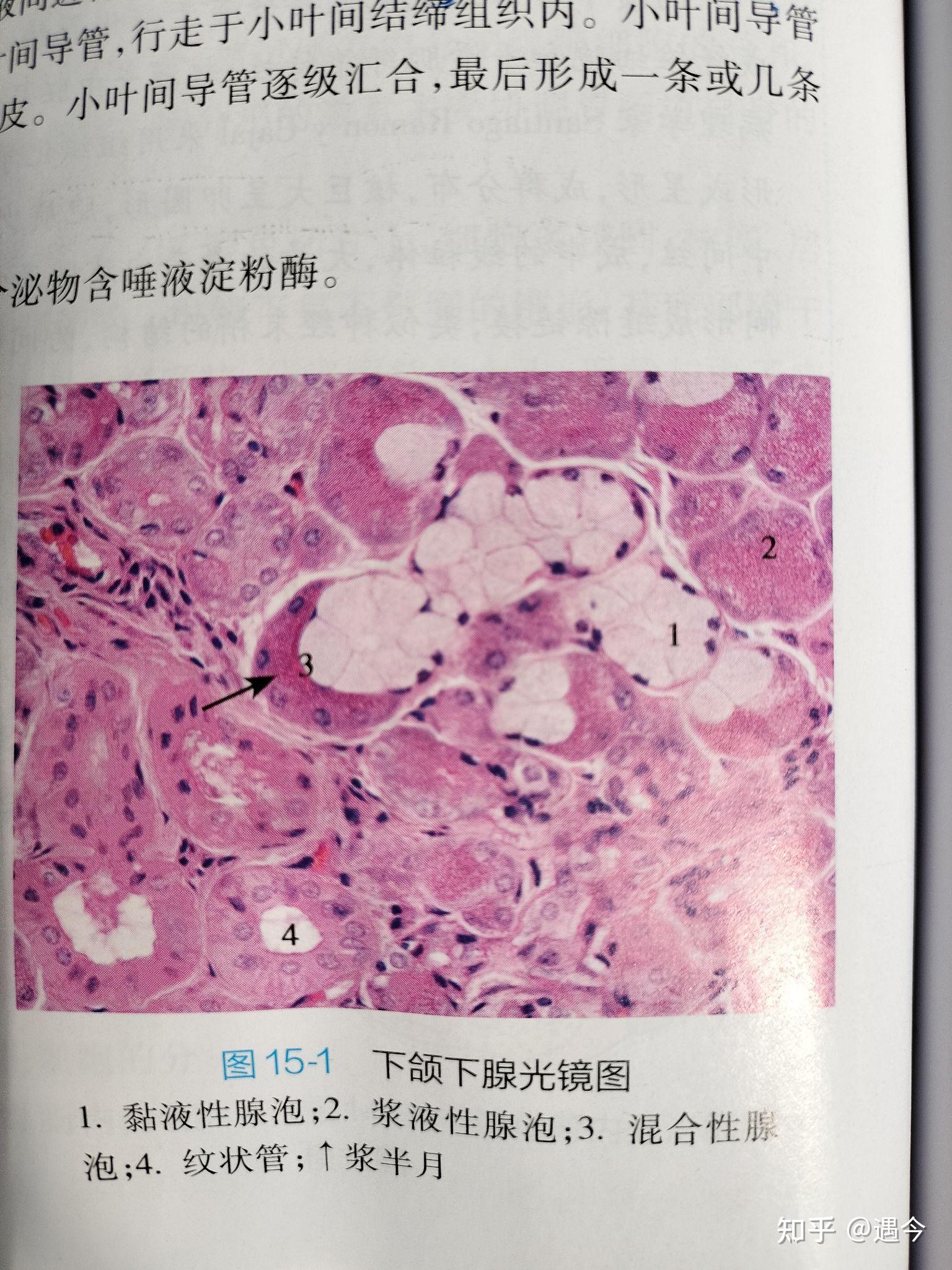 浆液性腺细胞图片