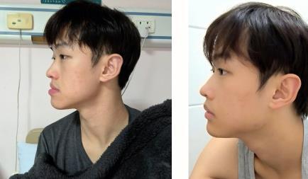 中国颌面(凸嘴,正颌)手术医生排名,看你了解的是否榜上有名? - 知乎