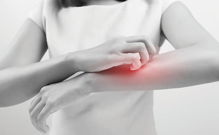 什么是酮疹 keto rash?酮疹了怎么办?低碳后皮肤瘙痒怎么办? - 知乎