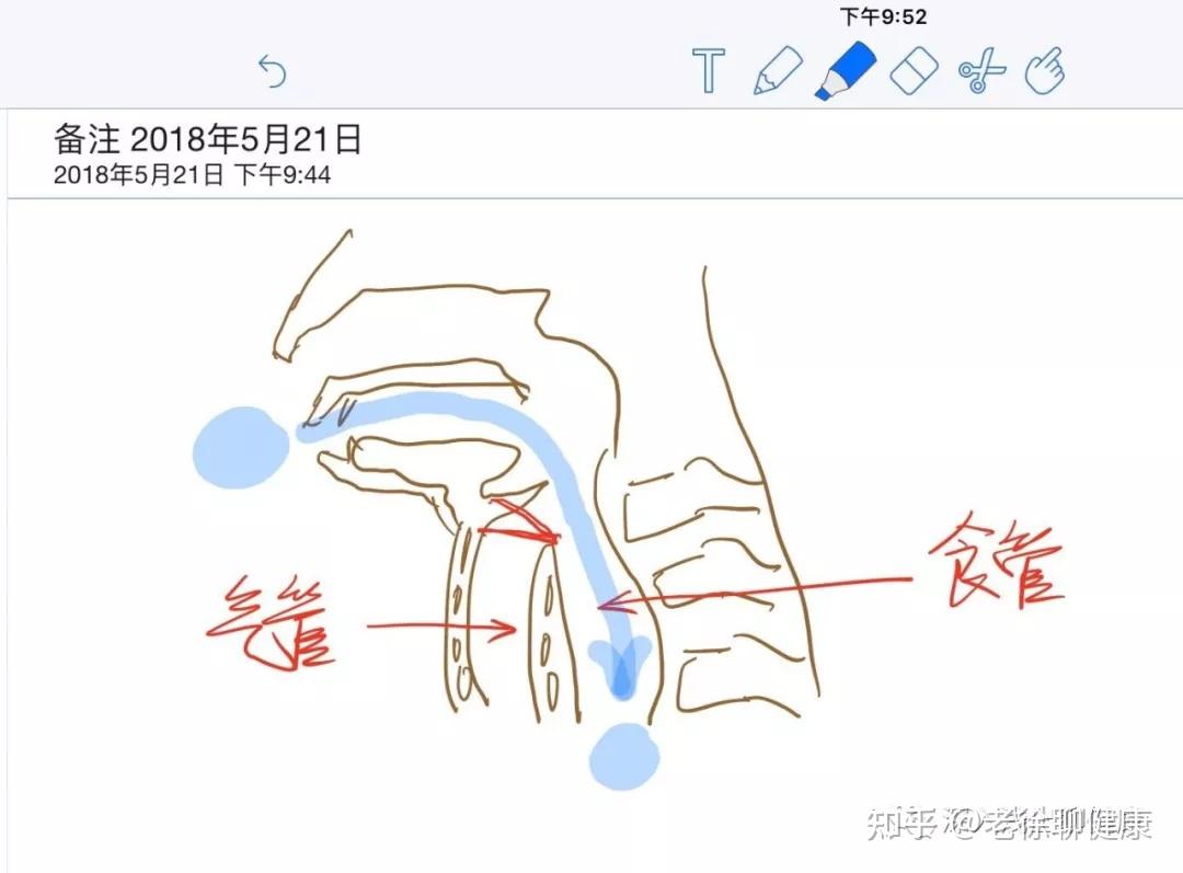 为什么孩子一边吃饭一边打闹容易呛---老徐聊健康系列之人体秘密篇5:会厌软骨 - 知乎