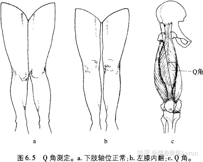 何为Q角?膝痛和它的关系是怎么样的 - 知乎